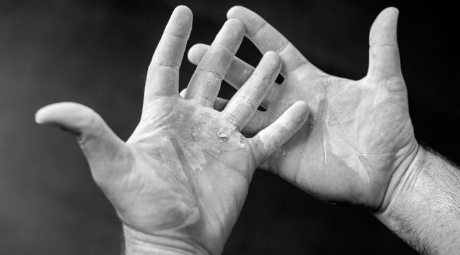 Ripped Hands 672x372 1